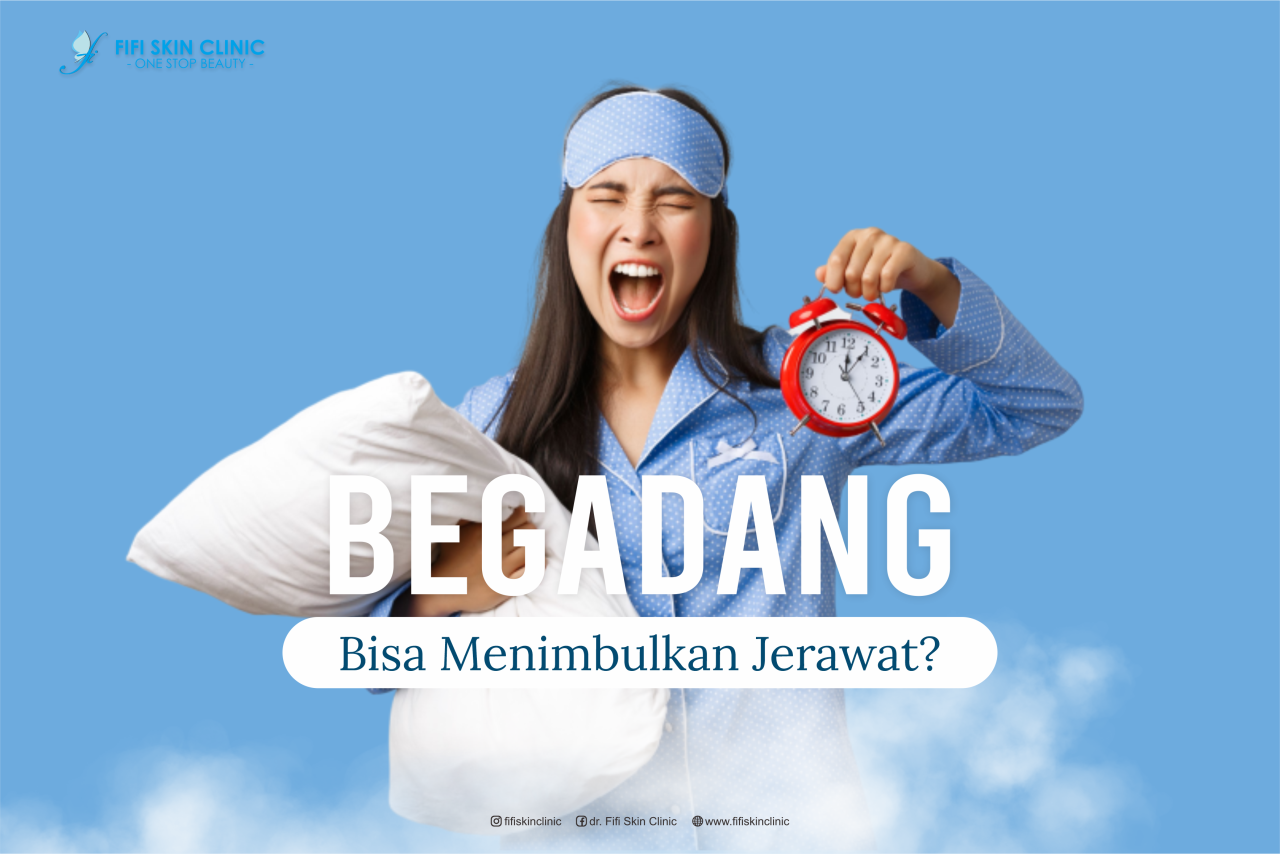 Begadang Bisa Menimbulkan Jerawat